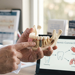 TrediDental_BlogImage_252x252 (3)